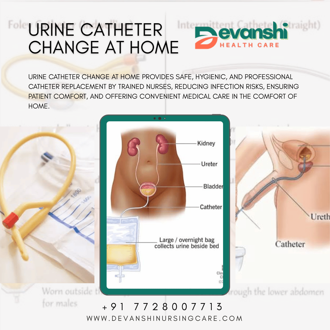 Urine Catheter Change at Home in Delhi NCR